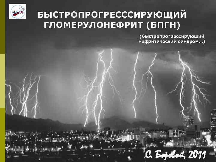 БЫСТРОПРОГРЕСССИРУЮЩИЙ ГЛОМЕРУЛОНЕФРИТ (БПГН) (быстропрогрессирующий нефритический синдром…) С. Боровой, 2011 