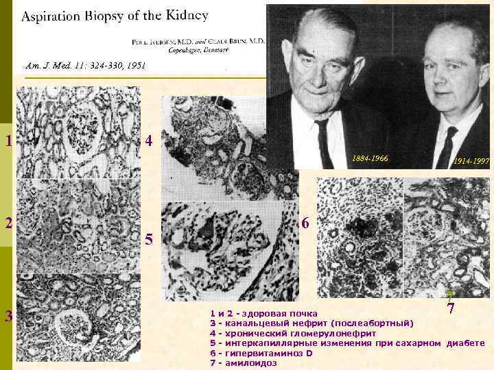 Am. J. Med. 11: 324 -330, 1951 1 4 1884 -1966 2 3 3