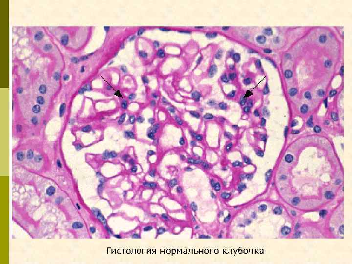 Гистология нормального клубочка 
