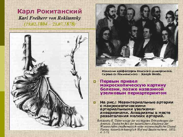 Карл Рокитанский Karl Freiherr von Rokitansky (19. 02. 1804 – 23. 07. 1878) Коллегия