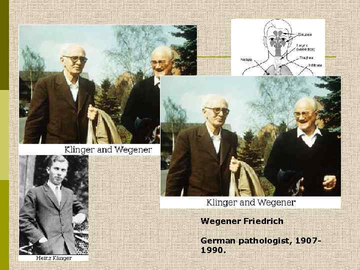 Wegener Friedrich German pathologist, 19071990. 