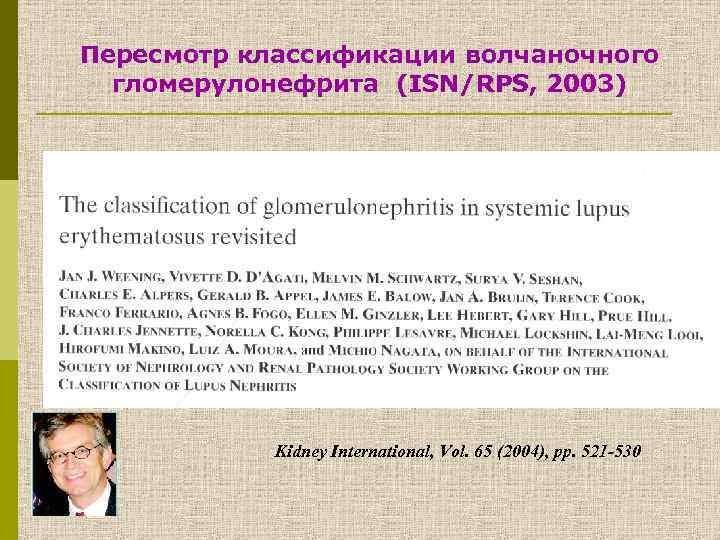 Пересмотр классификации волчаночного гломерулонефрита (ISN/RPS, 2003) Kidney International, Vol. 65 (2004), pp. 521 -530