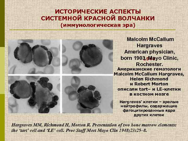 ИСТОРИЧЕСКИЕ АСПЕКТЫ СИСТЕМНОЙ КРАСНОЙ ВОЛЧАНКИ (иммунологическая эра) Malcolm Mc. Callum Hargraves American physician, born