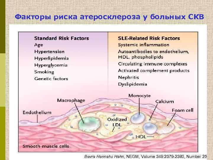 Факторы риска атеросклероза у больных СКВ Bevra Hannahs Hahn, NEGM, Volume 349: 2379 -2380,