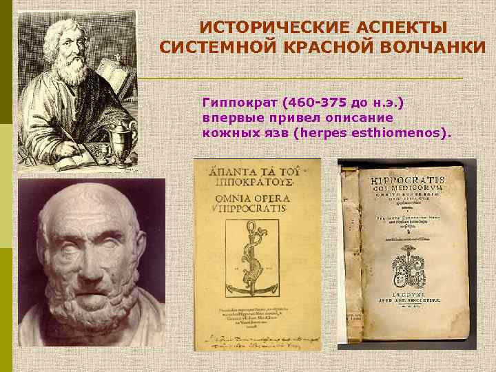 ИСТОРИЧЕСКИЕ АСПЕКТЫ СИСТЕМНОЙ КРАСНОЙ ВОЛЧАНКИ Гиппократ (460 -375 до н. э. ) впервые привел