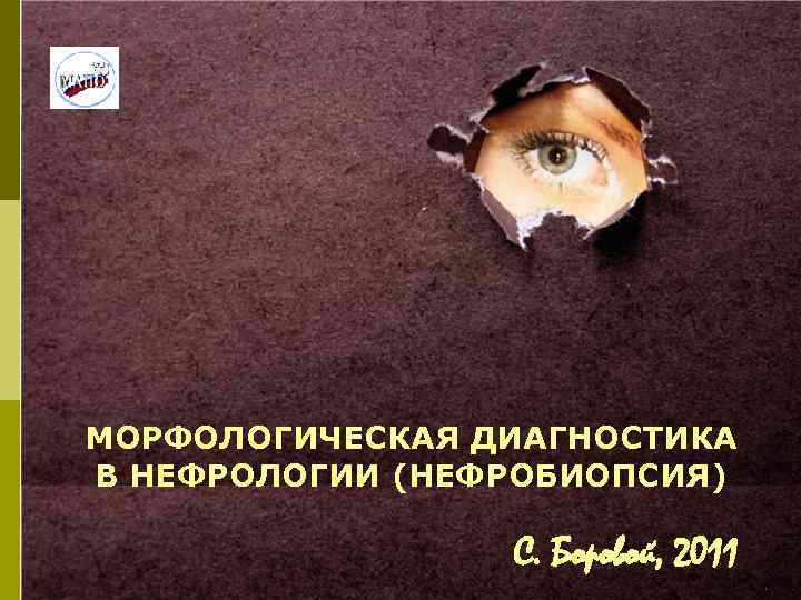 МОРФОЛОГИЧЕСКАЯ ДИАГНОСТИКА В НЕФРОЛОГИИ (НЕФРОБИОПСИЯ) С. Боровой, 2011 