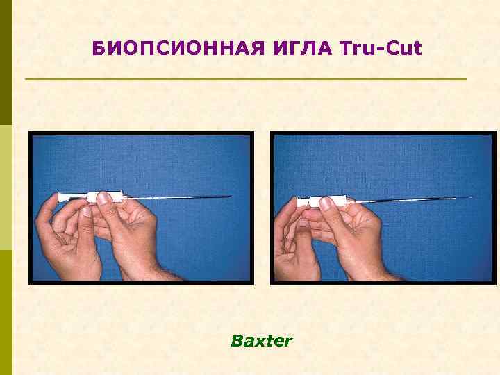 БИОПСИОННАЯ ИГЛА Tru-Cut Baxter 
