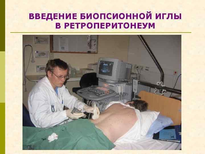 ВВЕДЕНИЕ БИОПСИОННОЙ ИГЛЫ В РЕТРОПЕРИТОНЕУМ 