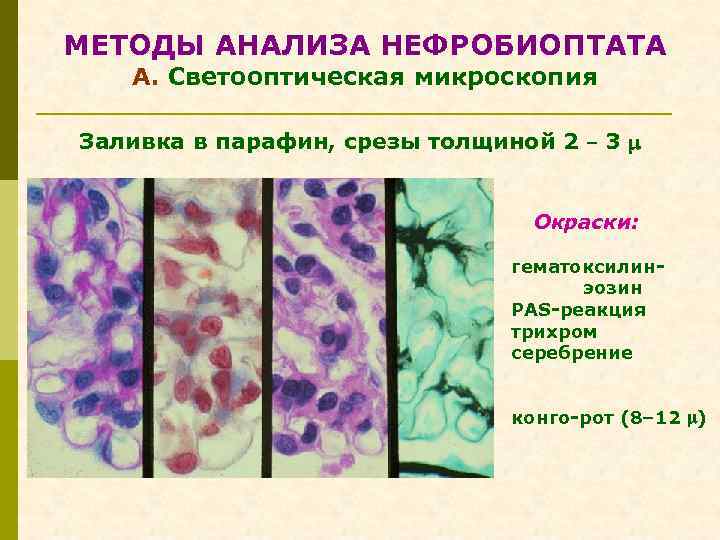 МЕТОДЫ АНАЛИЗА НЕФРОБИОПТАТА А. Светооптическая микроскопия Заливка в парафин, срезы толщиной 2 – 3