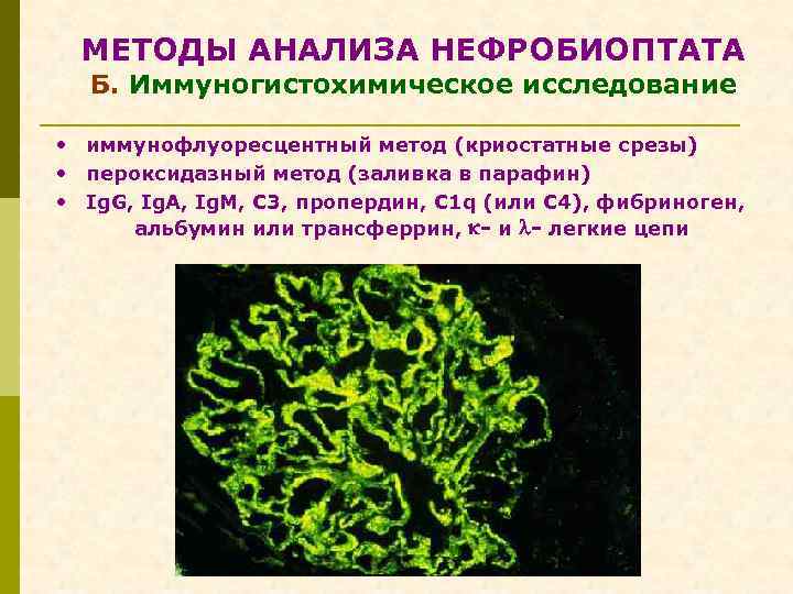 МЕТОДЫ АНАЛИЗА НЕФРОБИОПТАТА Б. Иммуногистохимическое исследование • иммунофлуоресцентный метод (криостатные срезы) • пероксидазный метод