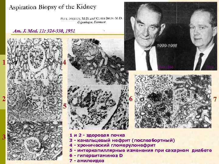 Am. J. Med. 11: 324 -330, 1951 1999 -1966 1 2 3 4 1884