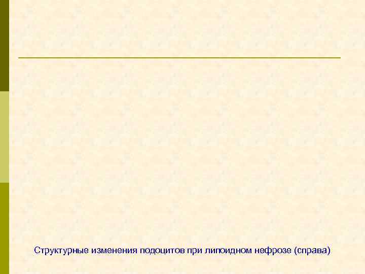 Структурные изменения подоцитов при липоидном нефрозе (справа) 