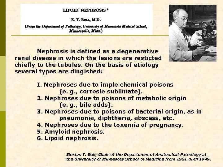 Nephrosis is defined as a degenerative renal disease in which the lesions are resticted