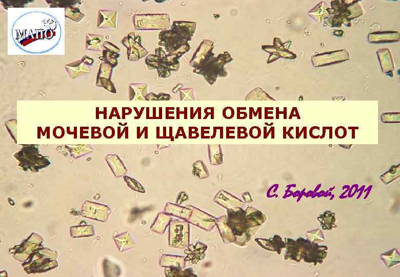 НАРУШЕНИЯ ОБМЕНА МОЧЕВОЙ И ЩАВЕЛЕВОЙ КИСЛОТ С. Боровой, 2011 