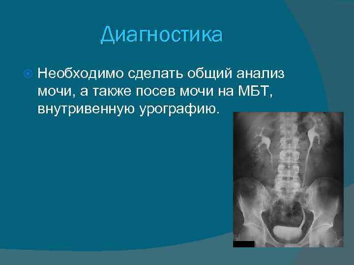 Диагностика Необходимо сделать общий анализ мочи, а также посев мочи на МБТ, внутривенную урографию.