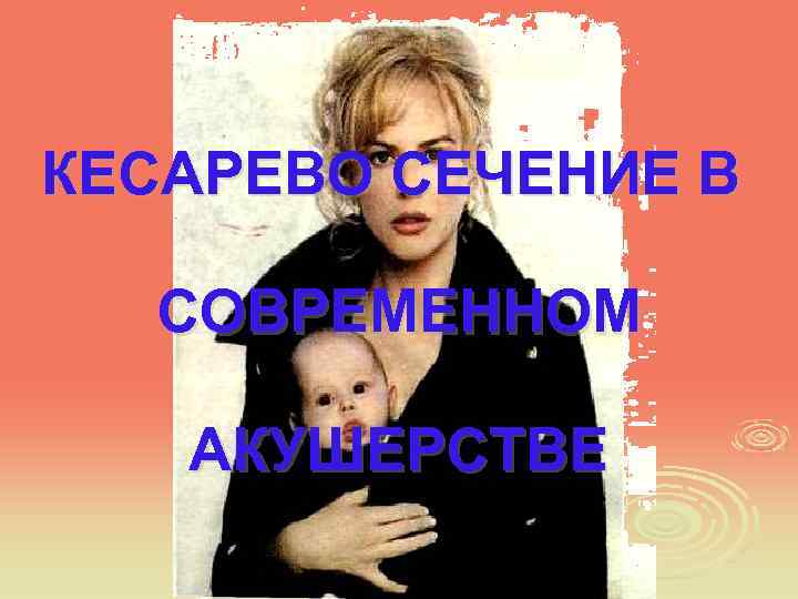 КЕСАРЕВО СЕЧЕНИЕ В СОВРЕМЕННОМ АКУШЕРСТВЕ 