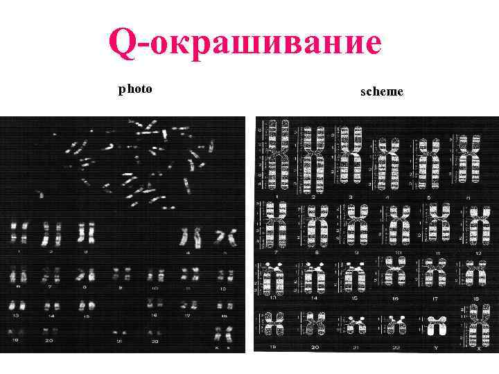 Q-окрашивание photo scheme 