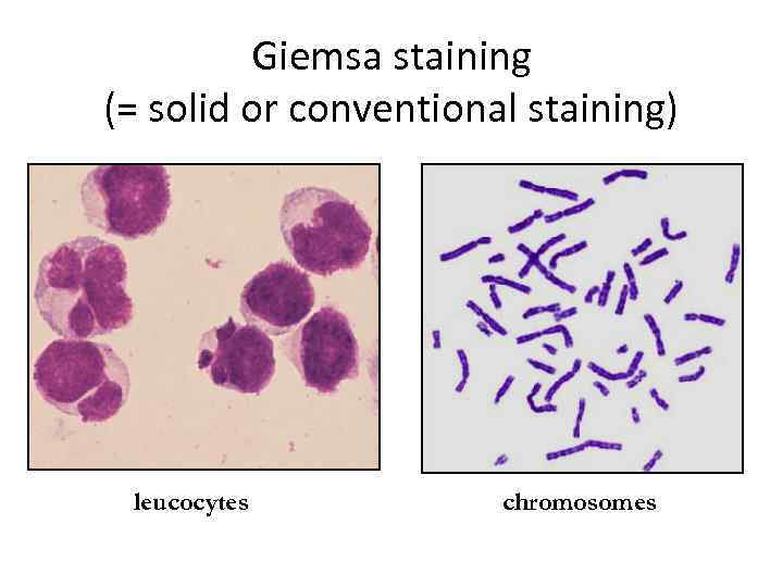 Giemsa staining (= solid or conventional staining) leucocytes chromosomes 