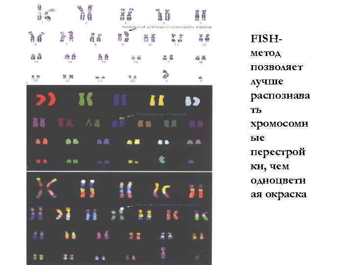 FISHметод позволяет лучше распознава ть хромосомн ые перестрой ки, чем одноцветн ая окраска 