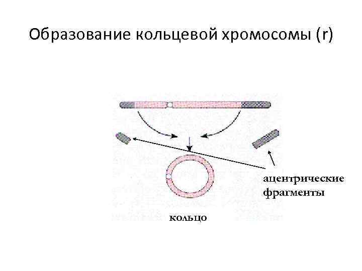 Кольцевая хромосома 2. Образование кольцевой хромосомы. Ацентрическая Кольцевая хромосома. Ацентрические ФРАГМЕНТЫ хромосом. Механизм образования кольцевой хромосомы.