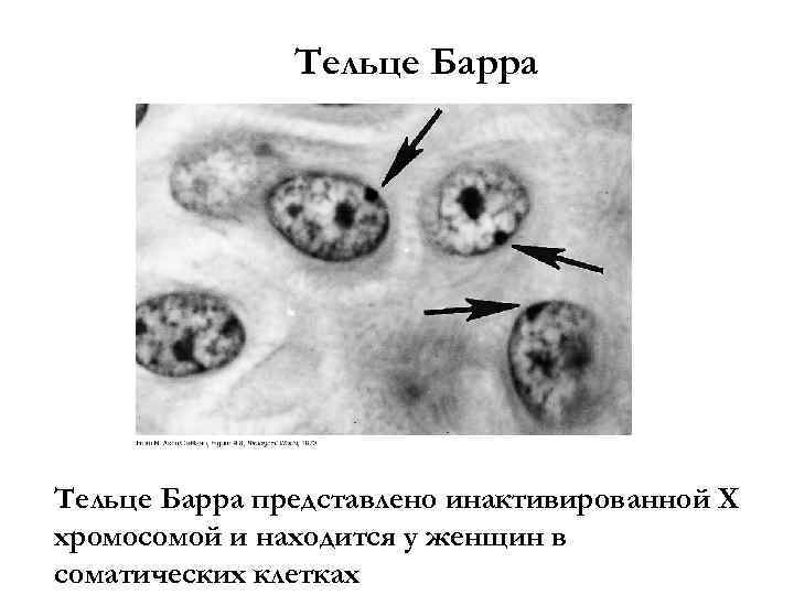 Тельце полового хроматина. Половой хроматин тельца Барра. Тельце Барра в клетках буккального эпителия. Тельце Барра гистология.