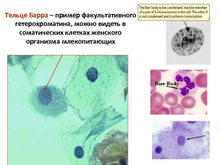 Тельце Барра – пример факультативного гетерохроматина, можно видеть в соматических клетках женского организма млекопитающих