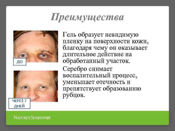 Преимущества ДО ЧЕРЕЗ 7 ДНЕЙ Гель образует невидимую пленку на поверхности кожи, благодаря чему