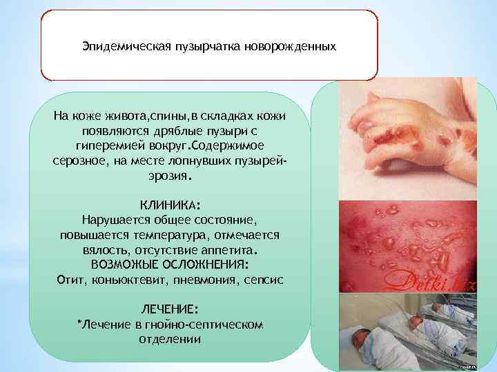 Эпидемическая пузырчатка новорожденных На коже живота, спины, в складках кожи появляются дряблые пузыри с