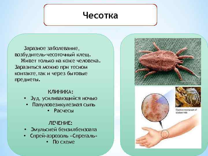 Чесотка Заразное заболевание, возбудитель-чесоточный клещ. Живет только на коже человека. Заразиться можно при тесном