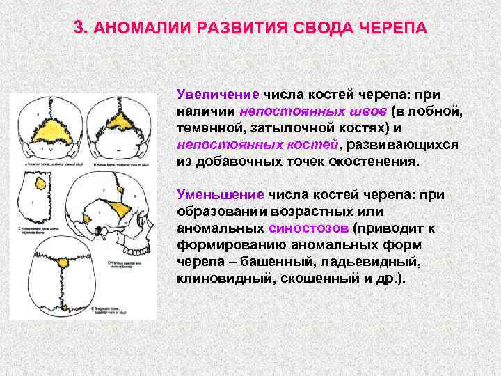 Врожденные аномалии костей черепа нмо ответы