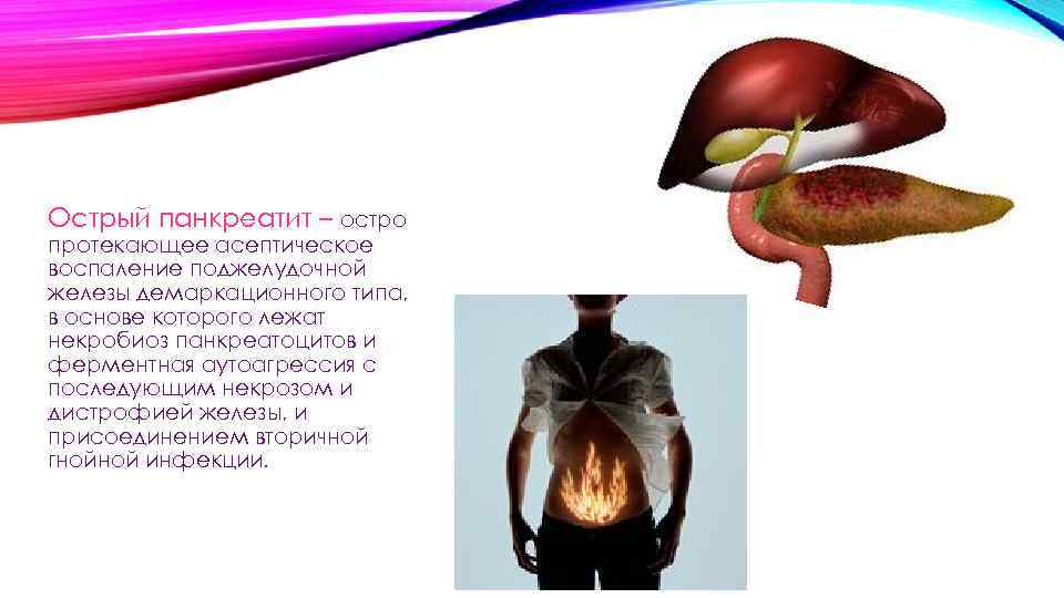 Острый панкреатит – остро протекающее асептическое воспаление поджелудочной железы демаркационного типа, в основе которого