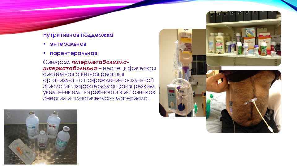 Нутритивная поддержка § энтеральная § парентеральная Синдром гиперметаболизмагиперкатаболизма – неспецифическая системная ответная реакция организма