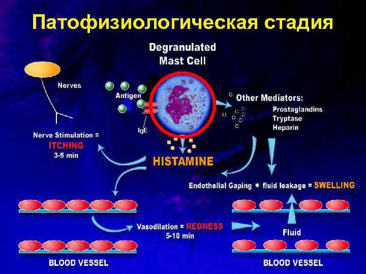 Патофизиологическая стадия Ig. E 