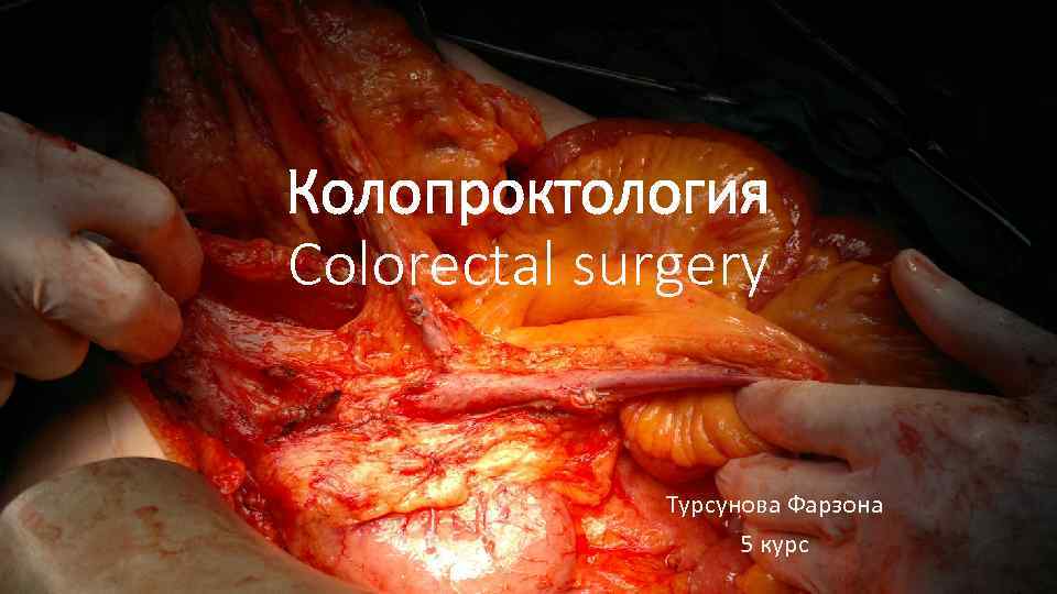 Колопроктология Colorectal surgery Турсунова Фарзона 5 курс 