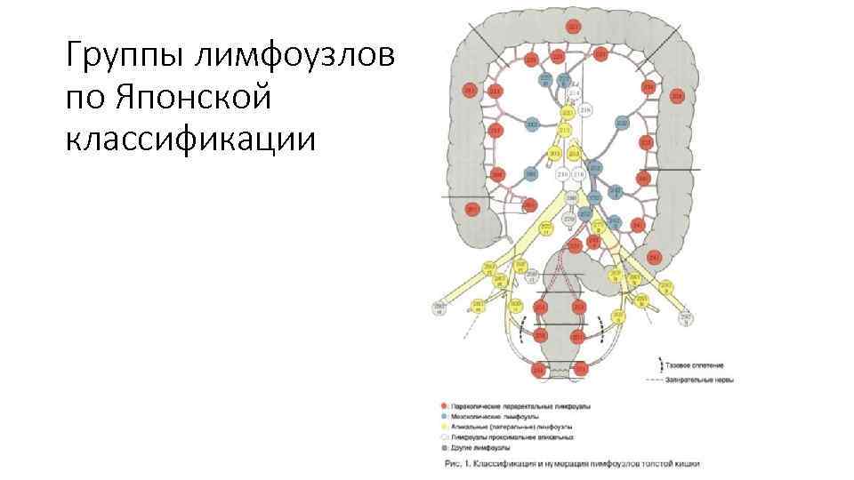 Группы лимфоузлов по Японской классификации 