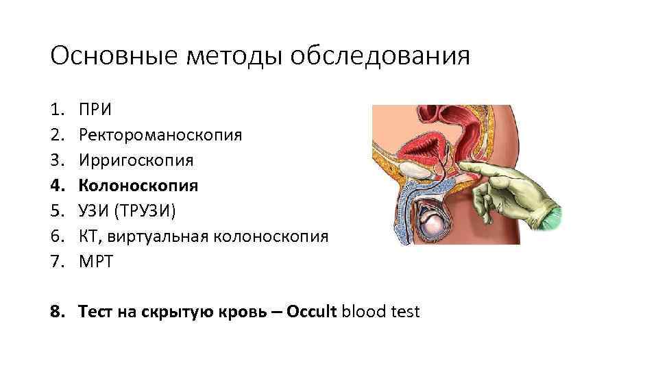 Основные методы обследования 1. 2. 3. 4. 5. 6. 7. ПРИ Ректороманоскопия Ирригоскопия Колоноскопия