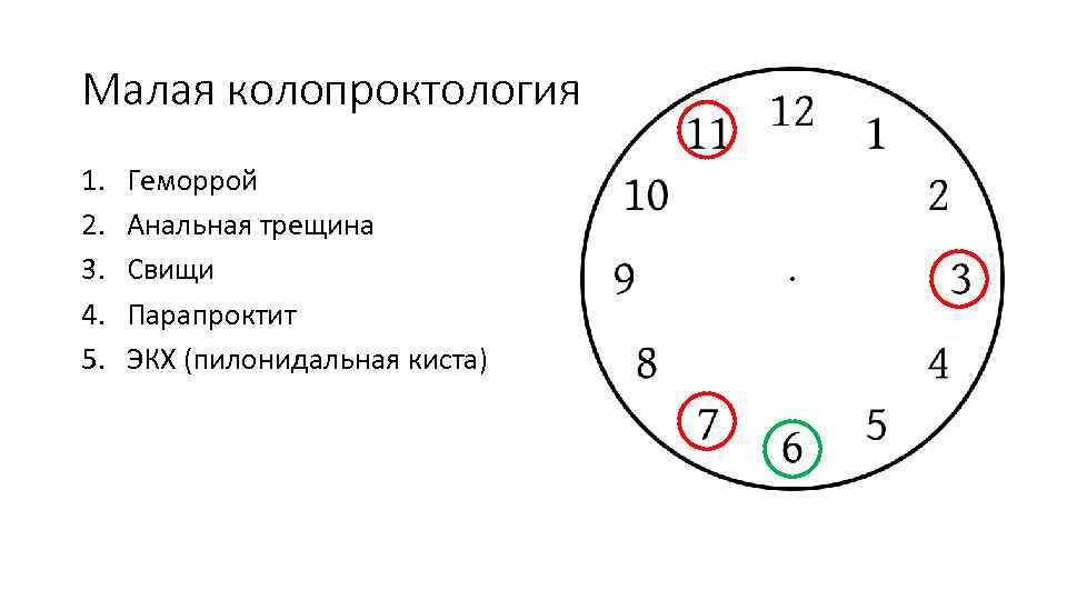 Малая колопроктология 1. 2. 3. 4. 5. Геморрой Анальная трещина Свищи Парапроктит ЭКХ (пилонидальная