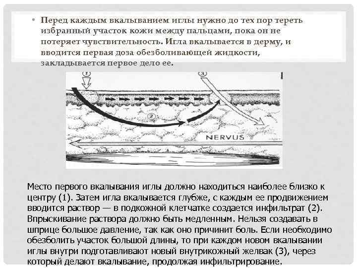  • Перед каждым вкалыванием иглы нужно до тех пор тереть избранный участок кожи