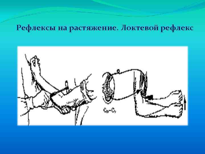 Рефлексы на растяжение. Локтевой рефлекс 