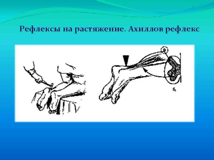 Рефлексы на растяжение. Ахиллов рефлекс 