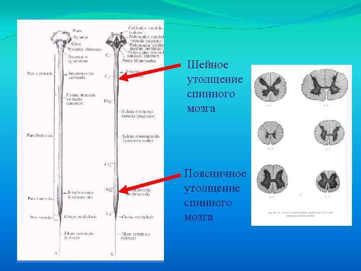 Шейное утолщение спинного мозга Поясничное утолщение спинного мозга 