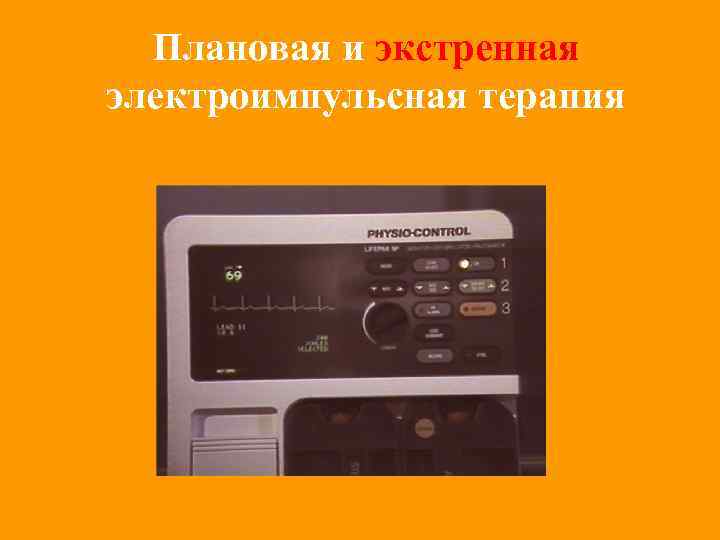 Плановая и экстренная электроимпульсная терапия 