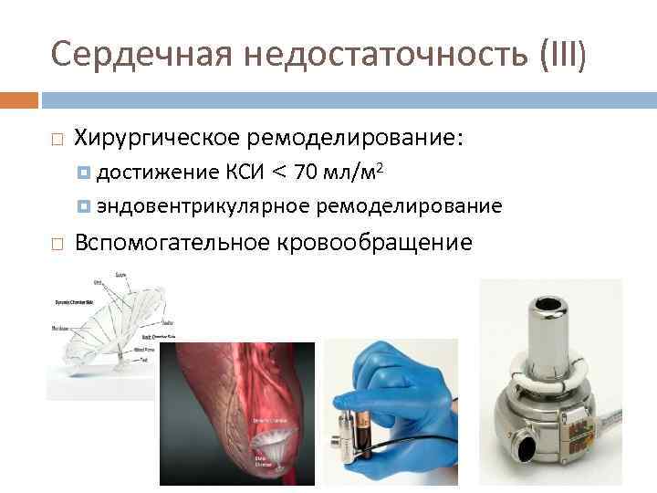 Сердечная недостаточность (III) Хирургическое ремоделирование: достижение КСИ < 70 мл/м 2 эндовентрикулярное ремоделирование Вспомогательное