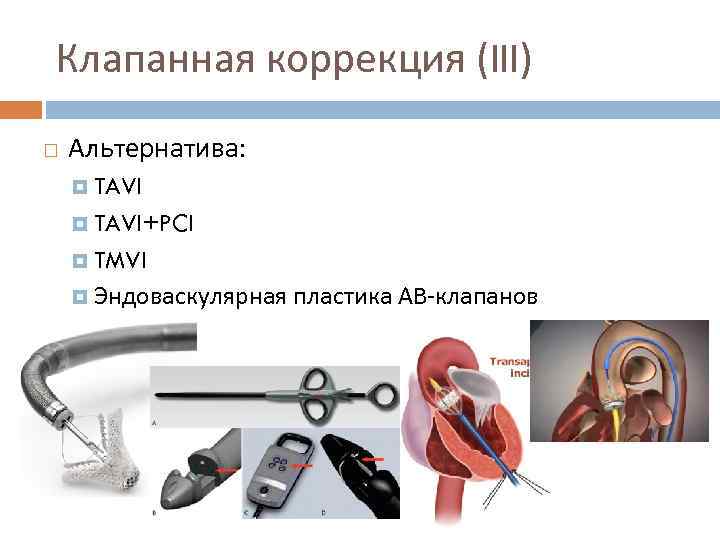 Клапанная коррекция (III) Альтернатива: TAVI+PCI TMVI Эндоваскулярная пластика АВ-клапанов 