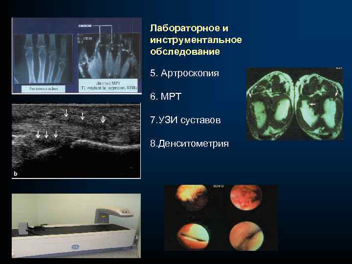 Лабораторное и инструментальное обследование 5. Артроскопия 6. МРТ 7. УЗИ суставов 8. Денситометрия 