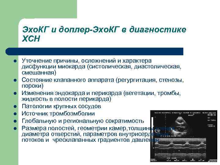 Эхо. КГ и доплер-Эхо. КГ в диагностике ХСН l l l l Уточнение причины,