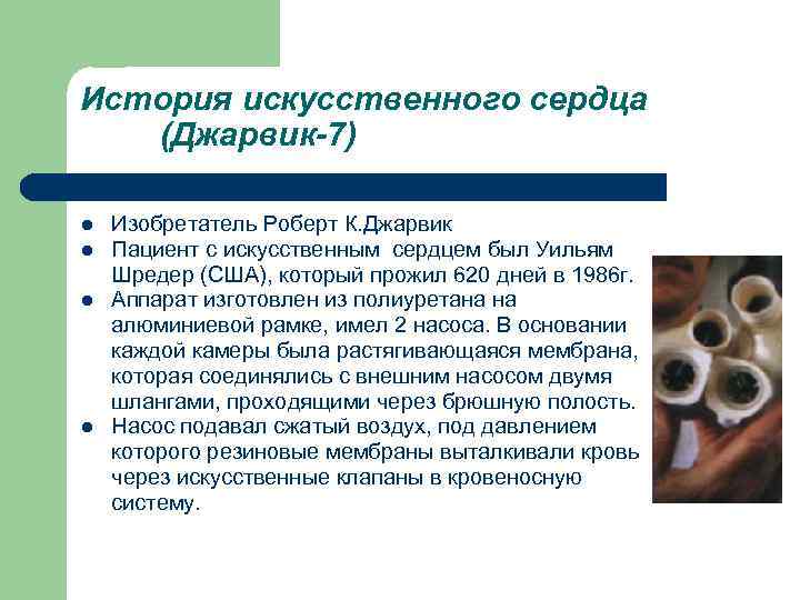 История иcкусственного cepдца (Джapвик-7) l l Изoбpeтaтeль Poбepт К. Джapвик Пaциeнт c иcкyccтвeнным cepдцeм