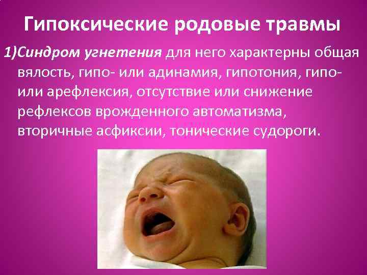 Гипоксические родовые травмы 1)Синдром угнетения для него характерны общая вялость, гипо- или адинамия, гипотония,