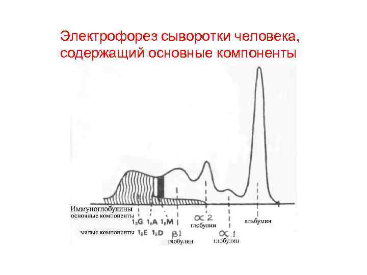 Электрофорез сыворотки человека, содержащий основные компоненты 