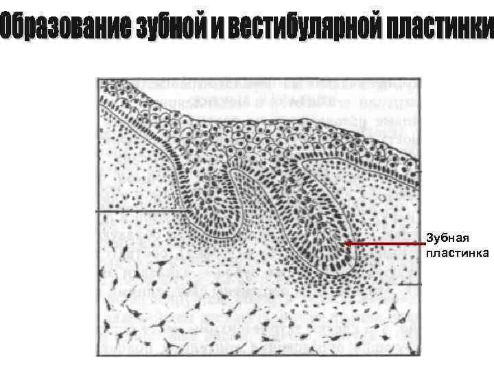 Зубная пластинка 